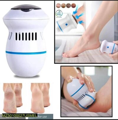 Foot Callus Remover